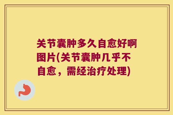 关节囊肿多久自愈好啊图片(关节囊肿几乎不自愈,需经处理) 关节囊肿多久自愈好啊图片(关节囊肿几乎不自愈,需经处理)