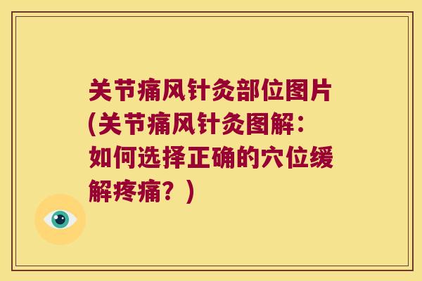 关节针灸部位图片(关节针灸图解:如何选择正确的穴位缓解?) 关节针灸部位图片(关节针灸图解:如何选择正确的穴位缓解?)