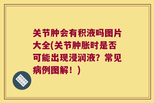 关节肿会有积液吗图片大全(关节时是否可能出现浸润液？常见例图解！)