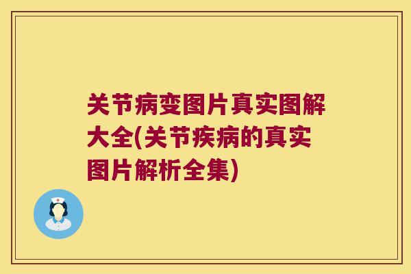 关节变图片真实图解大全(关节的真实图片解析全集) 关节变图片真实图解大全(关节的真实图片解析全集)