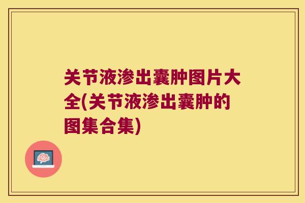 关节液渗出囊肿图片大全(关节液渗出囊肿的图集合集)