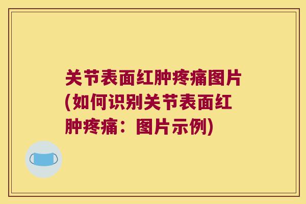关节表面红肿图片(如何识别关节表面红肿:图片示例) 关节表面红肿图片(如何识别关节表面红肿:图片示例)