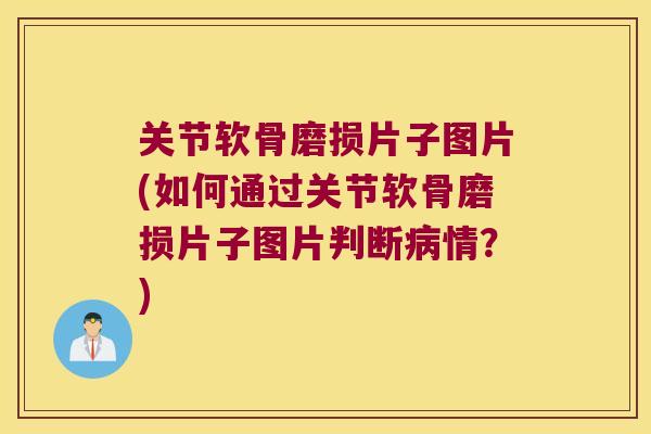 关节软骨磨损片子图片(如何通过关节软骨磨损片子图片判断情?) 关节软骨磨损片子图片(如何通过关节软骨磨损片子图片判断情?)