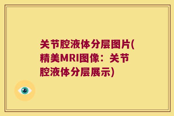 关节腔液体分层图片(精美MRI图像：关节腔液体分层展示)