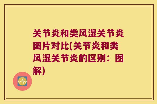 和类图片对比(和类的区别:图解) 和类图片对比(和类的区别:图解)