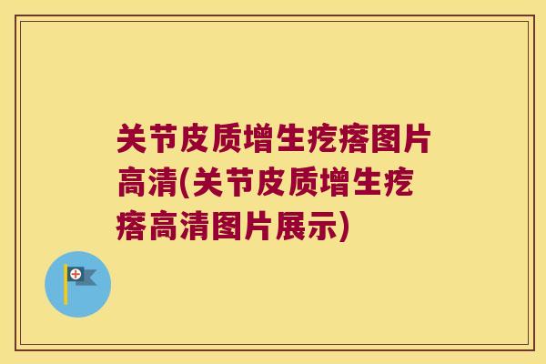 关节皮质增生疙瘩图片高清(关节皮质增生疙瘩高清图片展示) 关节皮质增生疙瘩图片高清(关节皮质增生疙瘩高清图片展示)