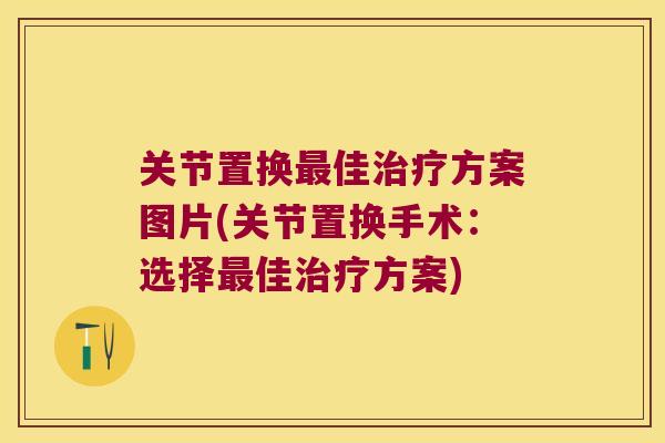 关节置换佳方案图片(关节置换手术：选择佳方案)