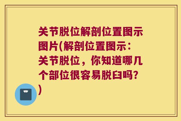 关节脱位解剖位置图示图片(解剖位置图示:关节脱位,你知道哪几个部位很容易脱臼吗?) 关节脱位解剖位置图示图片(解剖位置图示:关节脱位,你知道哪几个部位很容易脱臼吗?)