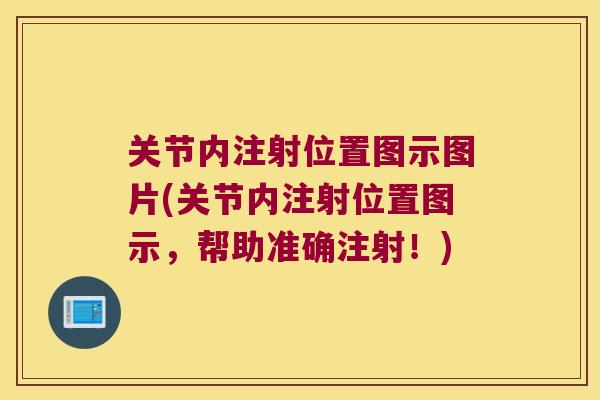 关节内注射位置图示图片(关节内注射位置图示,帮助准确注射!) 关节内注射位置图示图片(关节内注射位置图示,帮助准确注射!)