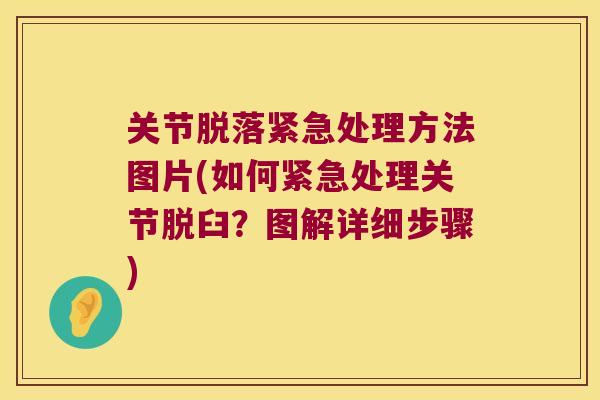 关节脱落紧急处理方法图片(如何紧急处理关节脱臼?图解详细步骤) 关节脱落紧急处理方法图片(如何紧急处理关节脱臼?图解详细步骤)