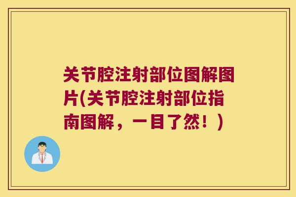 关节腔注射部位图解图片(关节腔注射部位指南图解,一目了然!) 关节腔注射部位图解图片(关节腔注射部位指南图解,一目了然!)