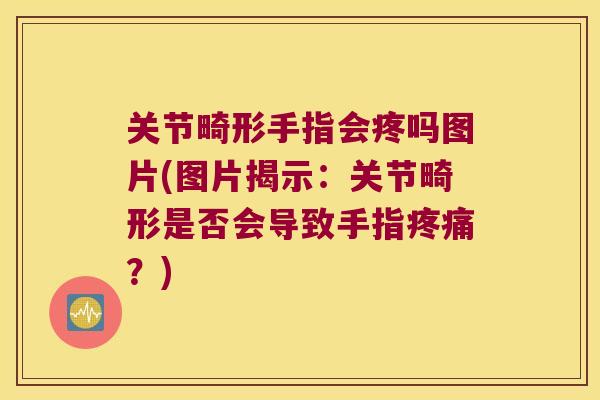 关节畸形手指会疼吗图片(图片揭示:关节畸形是否会导致手指?) 关节畸形手指会疼吗图片(图片揭示:关节畸形是否会导致手指?)