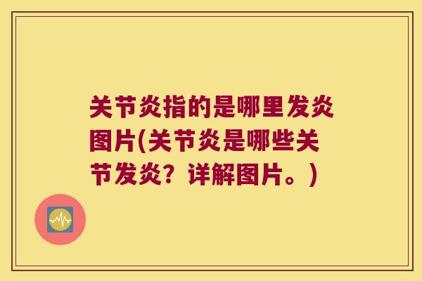 指的是哪里发炎图片(是哪些关节发炎?详解图片。) 指的是哪里发炎图片(是哪些关节发炎?详解图片。)