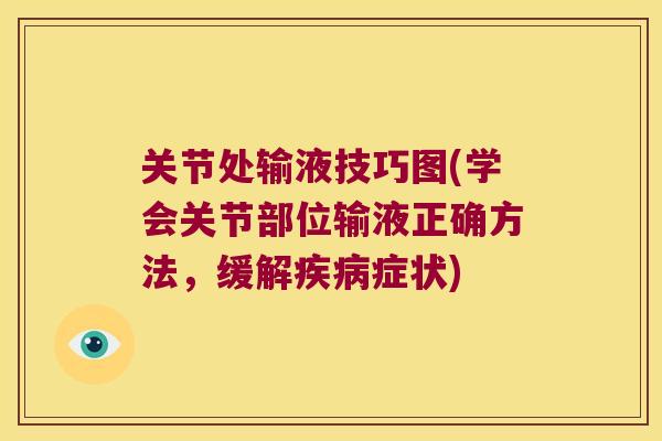 关节处输液技巧图(学会关节部位输液正确方法,缓解症状) 关节处输液技巧图(学会关节部位输液正确方法,缓解症状)