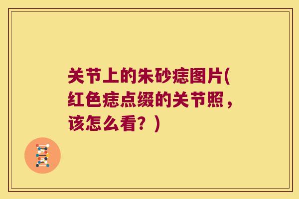 关节上的朱砂痣图片(红色痣点缀的关节照，该怎么看？)