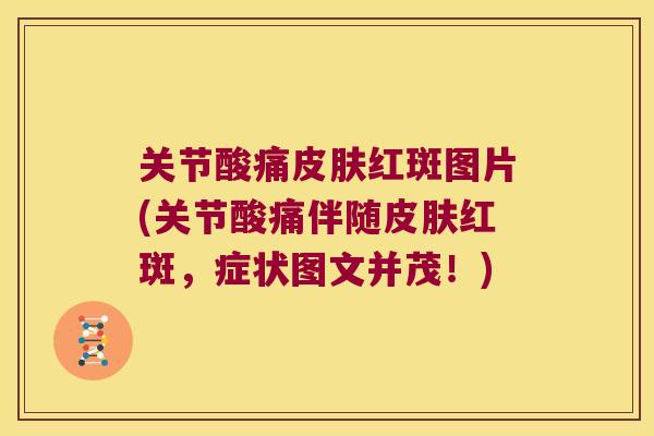 关节酸痛红斑图片(关节酸痛伴随红斑，症状图文并茂！)