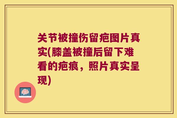 关节被撞伤留疤图片真实(膝盖被撞后留下难看的疤痕,照片真实呈现) 关节被撞伤留疤图片真实(膝盖被撞后留下难看的疤痕,照片真实呈现)