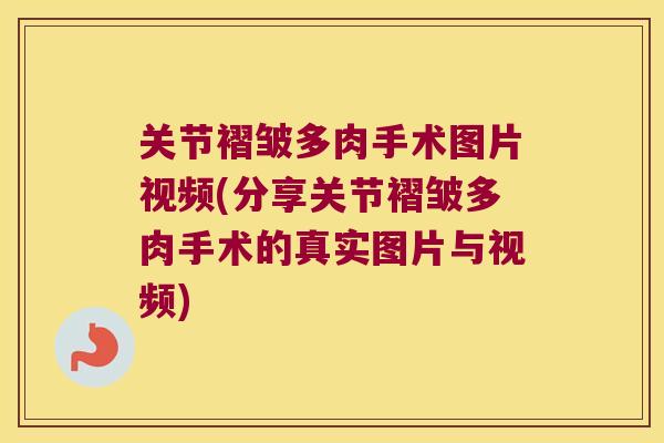 关节褶皱多肉手术图片视频(分享关节褶皱多肉手术的真实图片与视频)