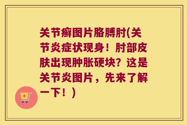 关节癣图片胳膊肘(关节状现身!肘部出现硬块?这是图片,先来了解一下!) 关节癣图片胳膊肘(关节状现身!肘部出现硬块?这是图片,先来了解一下!)