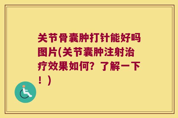 关节骨囊肿打针能好吗图片(关节囊肿注射效果如何?了解一下!) 关节骨囊肿打针能好吗图片(关节囊肿注射效果如何?了解一下!)