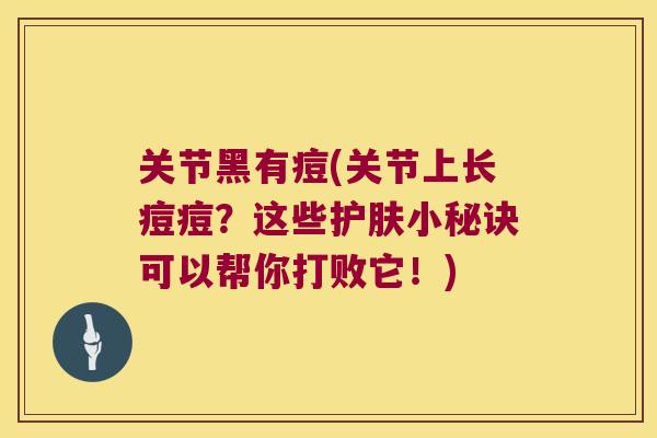 关节黑有痘(关节上长痘痘?这些护肤小秘诀可以帮你打败它!) 关节黑有痘(关节上长痘痘?这些护肤小秘诀可以帮你打败它!)