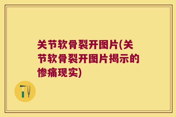关节软骨裂开图片(关节软骨裂开图片揭示的惨痛现实)