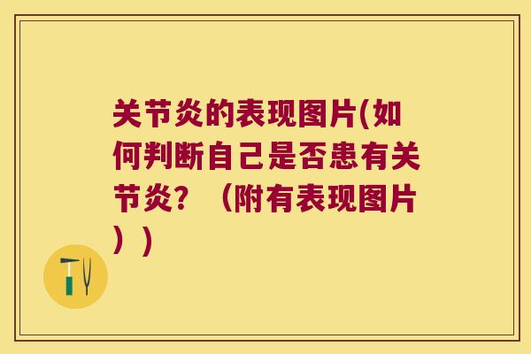 的表现图片(如何判断自己是否患有?(附有表现图片)) 的表现图片(如何判断自己是否患有?(附有表现图片))