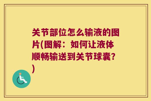 关节部位怎么输液的图片(图解：如何让液体顺畅输送到关节球囊？)