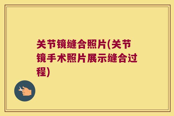关节镜缝合照片(关节镜手术照片展示缝合过程)