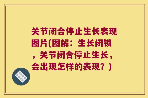 关节闭合停止生长表现图片(图解:生长闭锁,关节闭合停止生长,会出现怎样的表现?) 关节闭合停止生长表现图片(图解:生长闭锁,关节闭合停止生长,会出现怎样的表现?)