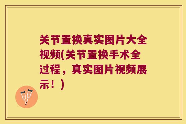 关节置换真实图片大全视频(关节置换手术全过程,真实图片视频展示!) 关节置换真实图片大全视频(关节置换手术全过程,真实图片视频展示!)