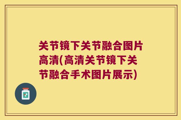 关节镜下关节融合图片高清(高清关节镜下关节融合手术图片展示) 关节镜下关节融合图片高清(高清关节镜下关节融合手术图片展示)