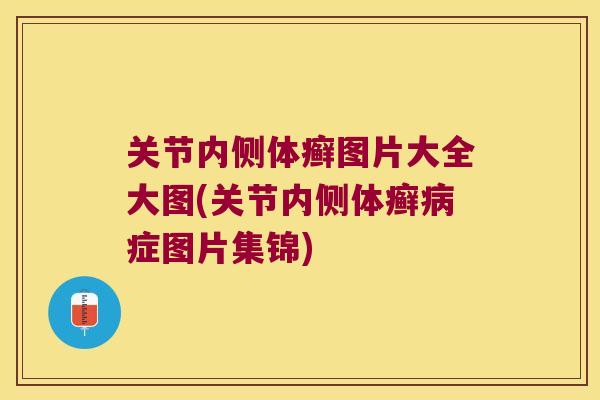 关节内侧体癣图片大全大图(关节内侧体癣症图片集锦) 关节内侧体癣图片大全大图(关节内侧体癣症图片集锦)