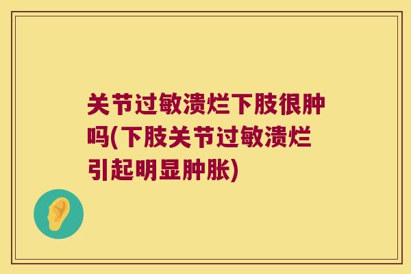 关节溃烂下肢很肿吗(下肢关节溃烂引起明显) 关节溃烂下肢很肿吗(下肢关节溃烂引起明显)