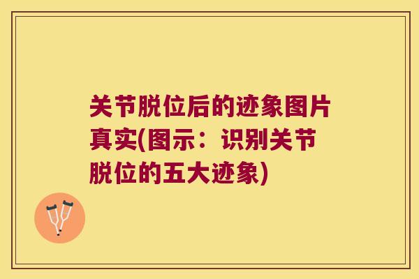 关节脱位后的迹象图片真实(图示:识别关节脱位的五大迹象) 关节脱位后的迹象图片真实(图示:识别关节脱位的五大迹象)