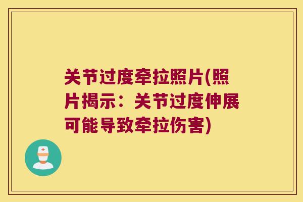 关节过度牵拉照片(照片揭示:关节过度伸展可能导致牵拉伤害) 关节过度牵拉照片(照片揭示:关节过度伸展可能导致牵拉伤害)