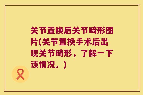 关节置换后关节畸形图片(关节置换手术后出现关节畸形，了解一下该情况。)
