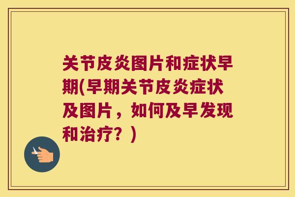 关节皮炎图片和症状早期(早期关节皮状及图片,如何及早发现和?) 关节皮炎图片和症状早期(早期关节皮状及图片,如何及早发现和?)