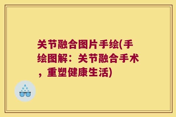 关节融合图片手绘(手绘图解：关节融合手术，重塑健康生活)