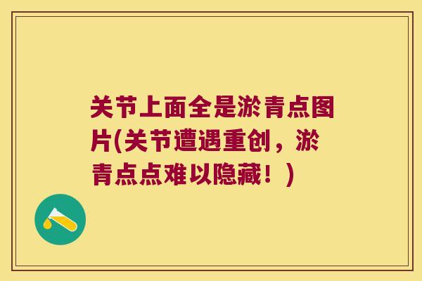 关节上面全是淤青点图片(关节遭遇重创,淤青点点难以隐藏!) 关节上面全是淤青点图片(关节遭遇重创,淤青点点难以隐藏!)