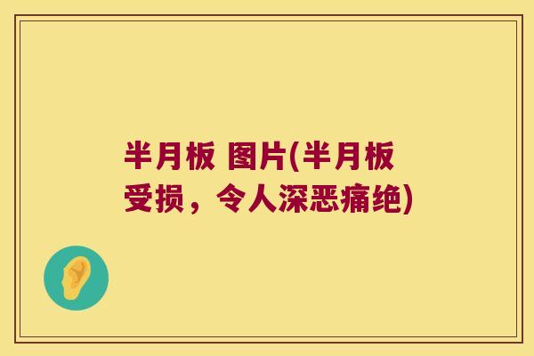  图片(受损，令人深恶痛绝)
