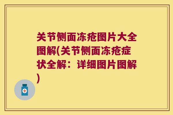 关节侧面冻疮图片大全图解(关节侧面冻疮症状全解：详细图片图解)