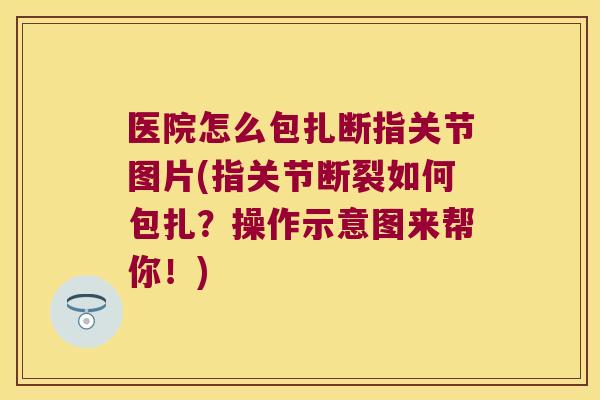 医院怎么包扎断指关节图片(指关节断裂如何包扎?操作示意图来帮你!) 医院怎么包扎断指关节图片(指关节断裂如何包扎?操作示意图来帮你!)