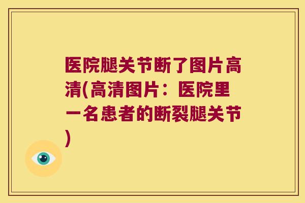 医院腿关节断了图片高清(高清图片:医院里一名患者的断裂腿关节) 医院腿关节断了图片高清(高清图片:医院里一名患者的断裂腿关节)