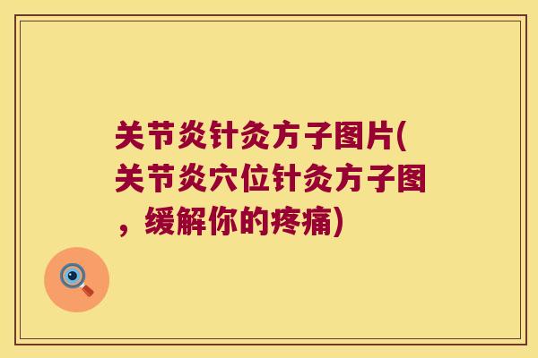 针灸方子图片(穴位针灸方子图，缓解你的)