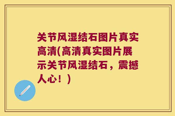 关节结石图片真实高清(高清真实图片展示关节结石，震撼人心！)