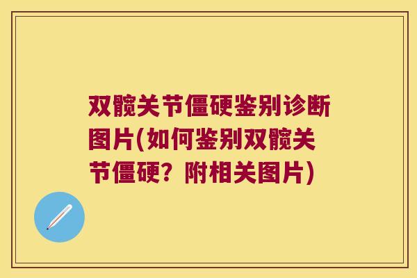 双髋关节鉴别诊断图片(如何鉴别双髋关节?附相关图片) 双髋关节鉴别诊断图片(如何鉴别双髋关节?附相关图片)