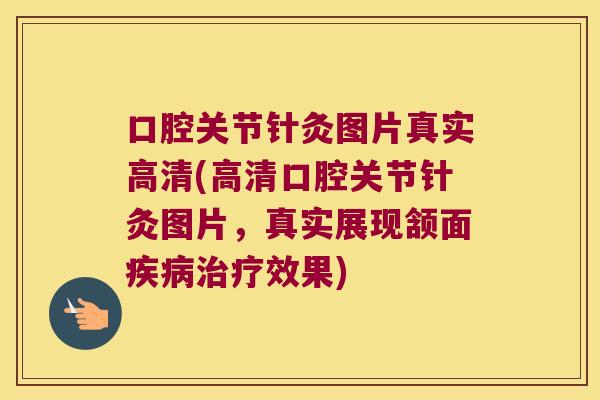 口腔关节针灸图片真实高清(高清口腔关节针灸图片,真实展现颔面效果) 口腔关节针灸图片真实高清(高清口腔关节针灸图片,真实展现颔面效果)
