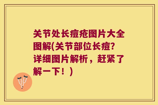 关节处长痘疮图片大全图解(关节部位长痘？详细图片解析，赶紧了解一下！)