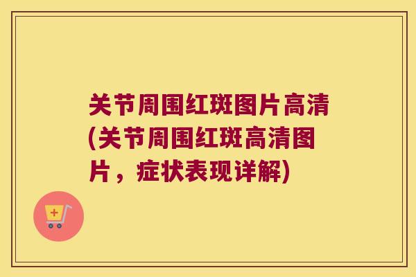 关节周围红斑图片高清(关节周围红斑高清图片，症状表现详解)